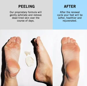 Holika Holika BABY Silky Foot One Shot Peeling