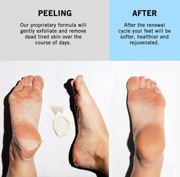 Holika Holika BABY Silky Foot One Shot Peeling